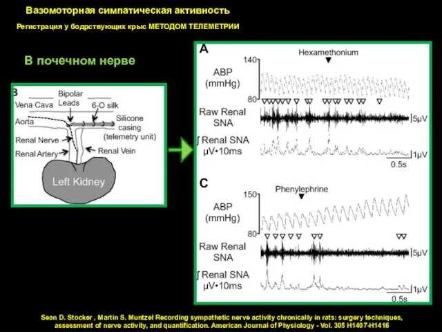 Вазомоторная симпатическая активность Регистрация у бодрствующих крыс МЕТОДОМ ТЕЛЕМЕТРИИ Sean D. Stocker