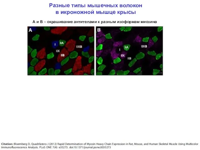 Разные типы мышечных волокон в икроножной мышце крысы А и В –