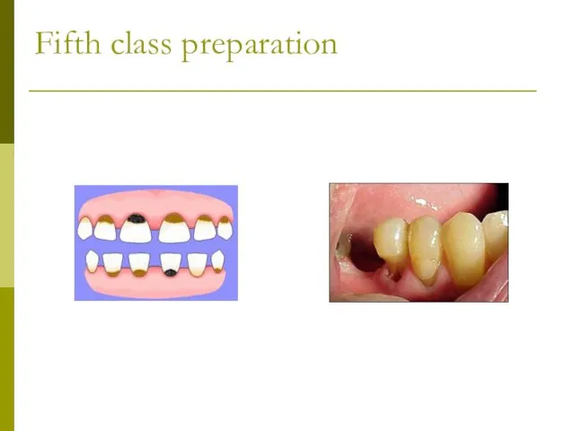 Fifth class preparation