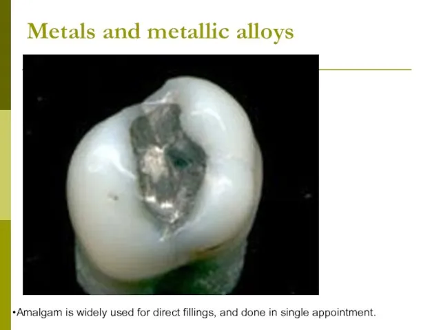 Metals and metallic alloys Amalgam is widely used for direct fillings, and done in single appointment.