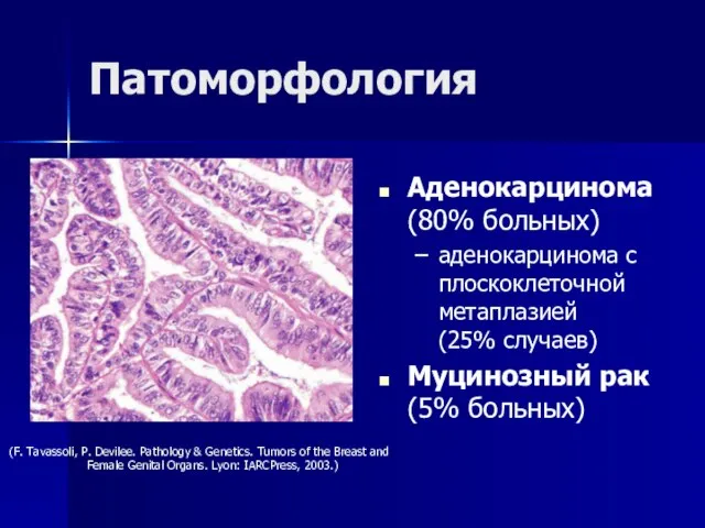 Патоморфология Аденокарцинома (80% больных) аденокарцинома с плоскоклеточной метаплазией (25% случаев) Муцинозный рак