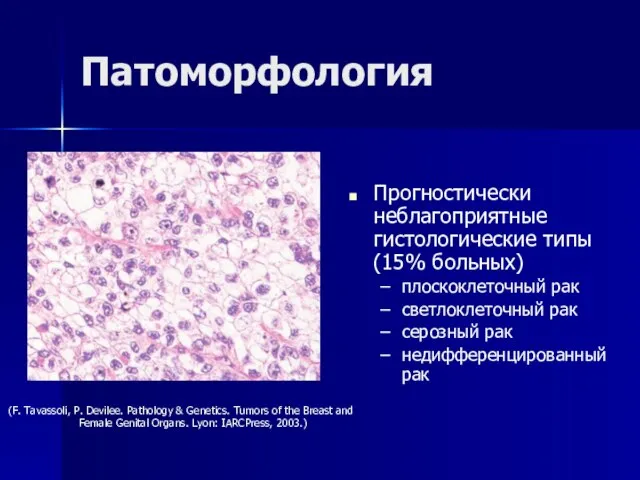 Патоморфология Прогностически неблагоприятные гистологические типы (15% больных) плоскоклеточный рак светлоклеточный рак серозный
