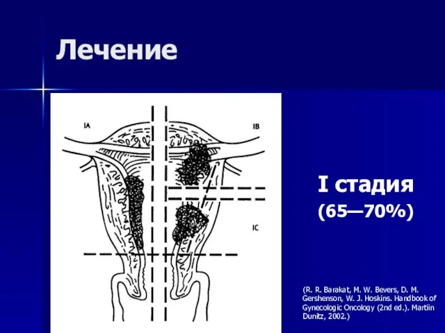 Лечение I стадия (65—70%) (R. R. Barakat, M. W. Bevers, D. M.