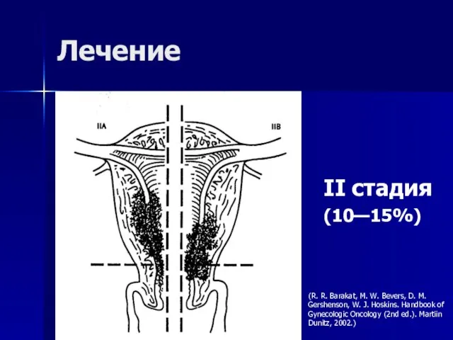 Лечение II стадия (10—15%) (R. R. Barakat, M. W. Bevers, D. M.