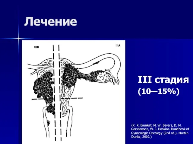 Лечение III стадия (10—15%) (R. R. Barakat, M. W. Bevers, D. M.