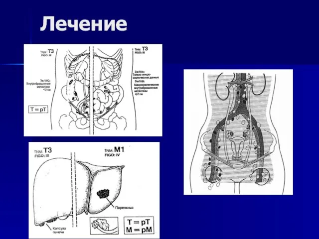 Лечение