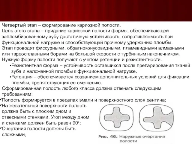 Четвертый этап – формирование кариозной полости. Цель этого этапа – придание кариозной