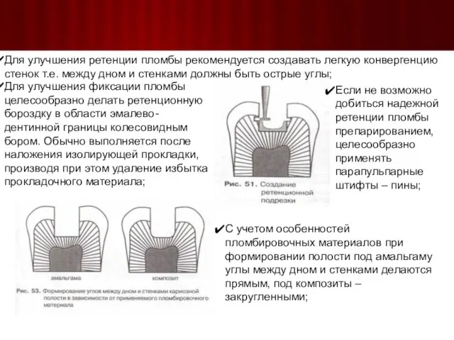 Для улучшения ретенции пломбы рекомендуется создавать легкую конвергенцию стенок т.е. между дном