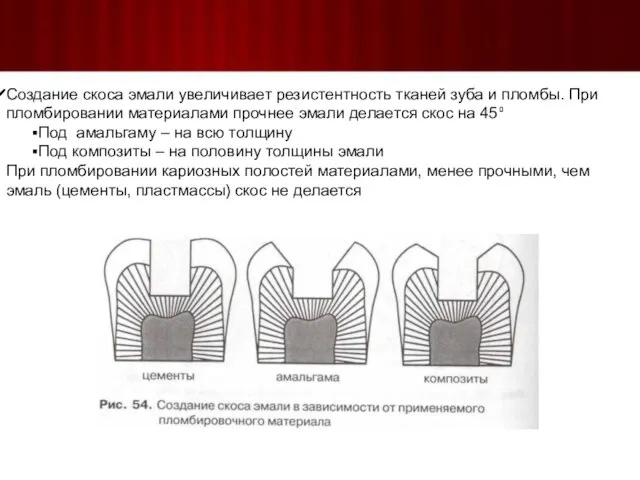 Создание скоса эмали увеличивает резистентность тканей зуба и пломбы. При пломбировании материалами