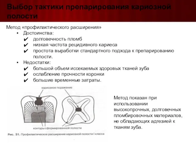 Выбор тактики препарирования кариозной полости Метод «профилактического расширения» Достоинства: долговечность пломб низкая