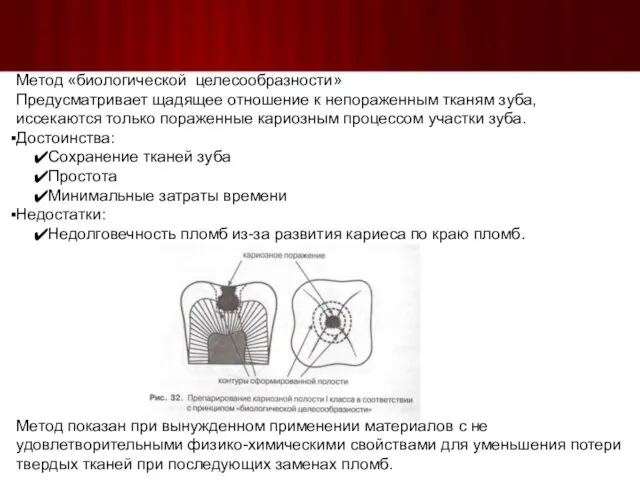 Метод «биологической целесообразности» Предусматривает щадящее отношение к непораженным тканям зуба, иссекаются только