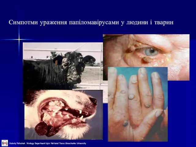 Симпотми ураження папіломавірусами у людини і тварин