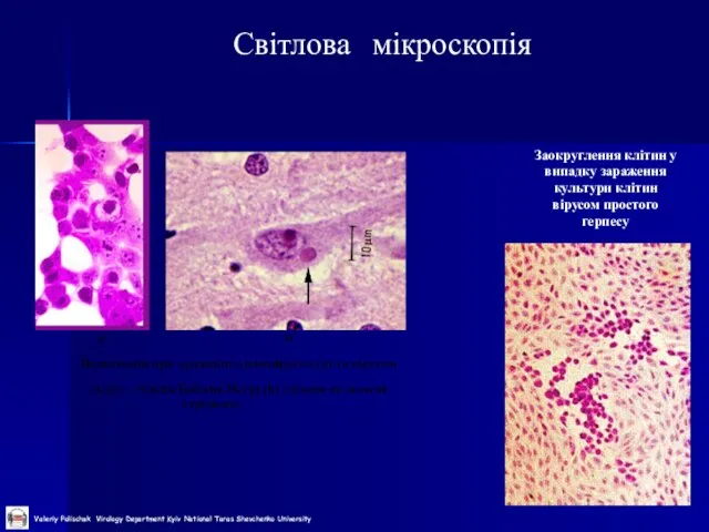 Світлова мікроскопія Заокруглення клітин у випадку зараження культури клітин вірусом простого герпесу