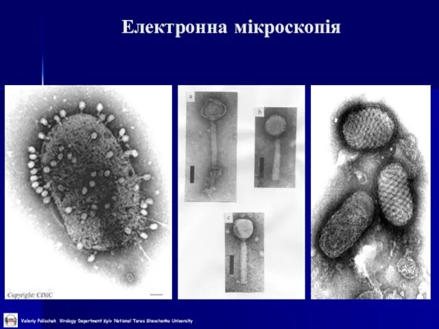 Електронна мікроскопія