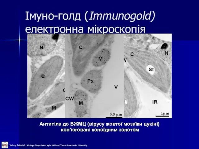 Імуно-голд (Immunogold) електронна мікроскопія Антитіла до ВЖМЦ (вірусу жовтої мозаїки цукіні) кон’юговані колоїдним золотом