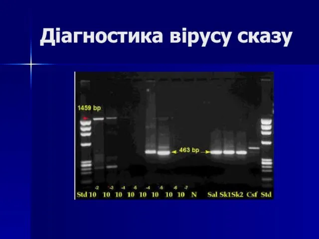 Діагностика вірусу сказу