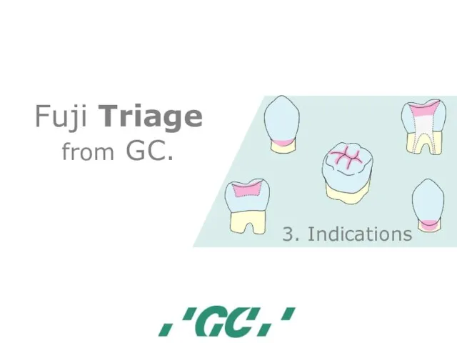 Fuji Triage from GC. 3. Indications