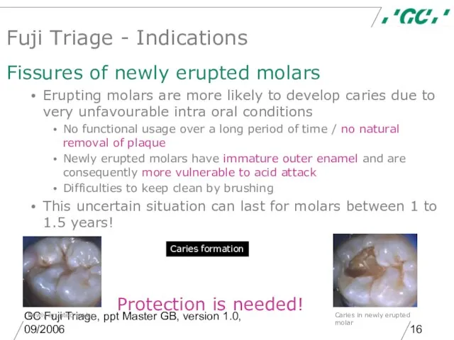 GC Fuji Triage, ppt Master GB, version 1.0, 09/2006 Caries formation Fuji