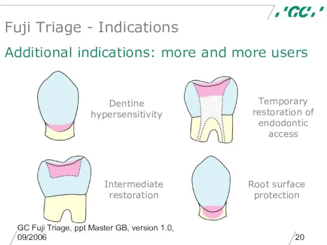 GC Fuji Triage, ppt Master GB, version 1.0, 09/2006 Dentine hypersensitivity Fuji