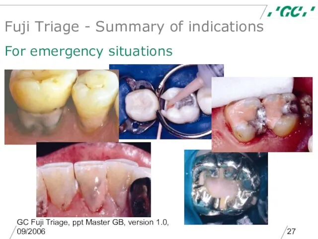 GC Fuji Triage, ppt Master GB, version 1.0, 09/2006 Fuji Triage -