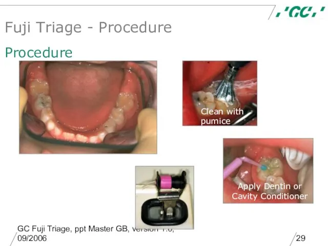 GC Fuji Triage, ppt Master GB, version 1.0, 09/2006 Fuji Triage -