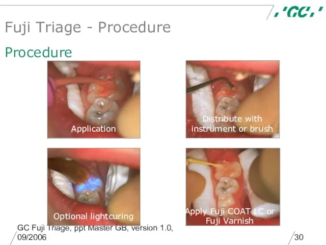 GC Fuji Triage, ppt Master GB, version 1.0, 09/2006 Fuji Triage -