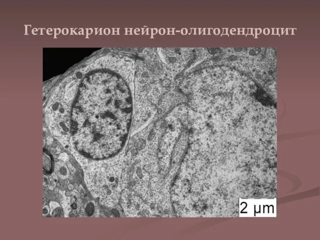Гетерокарион нейрон-олигодендроцит