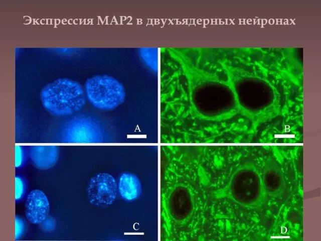 Экспрессия МАР2 в двухъядерных нейронах