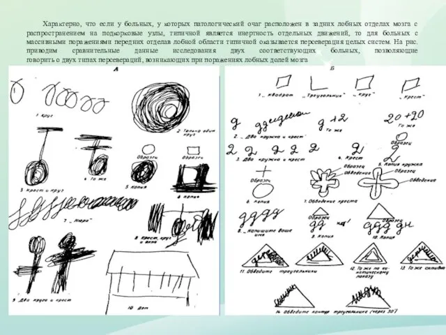 Характерно, что если у больных, у которых патологический очаг расположен в задних