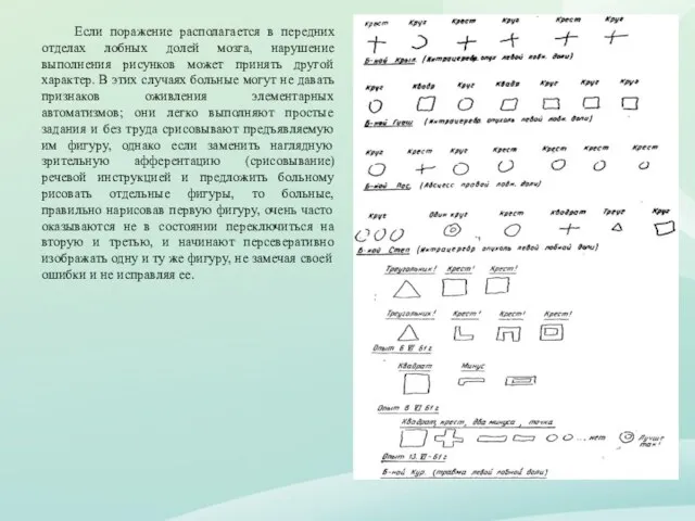 Если поражение располагается в передних отделах лобных долей мозга, нарушение выполнения рисунков