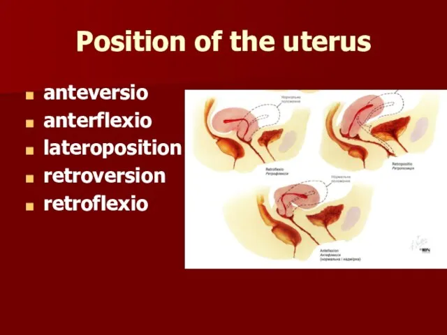 Position of the uterus anteversio anterflexio lateroposition retroversion retroflexio
