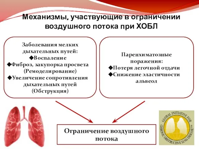 Механизмы, участвующие в ограничении воздушного потока при ХОБЛ Заболевания мелких дыхательных путей: