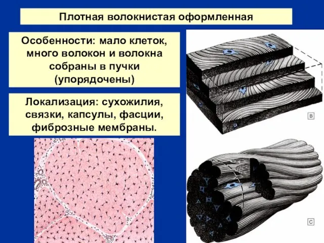 Плотная волокнистая оформленная Особенности: мало клеток, много волокон и волокна собраны в