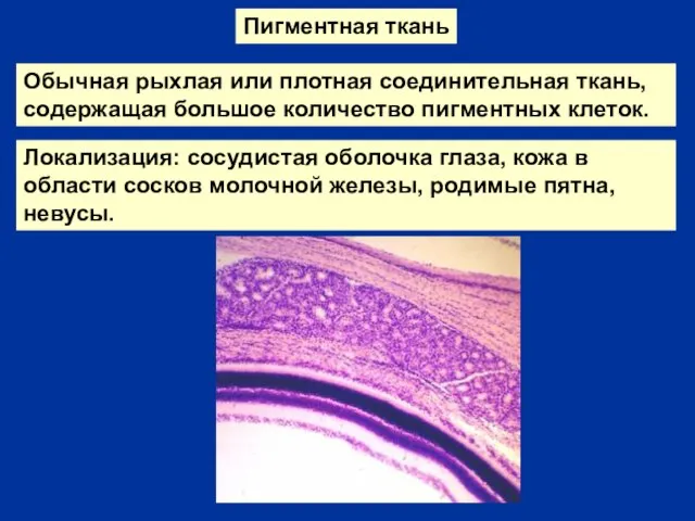 Пигментная ткань Локализация: сосудистая оболочка глаза, кожа в области сосков молочной железы,