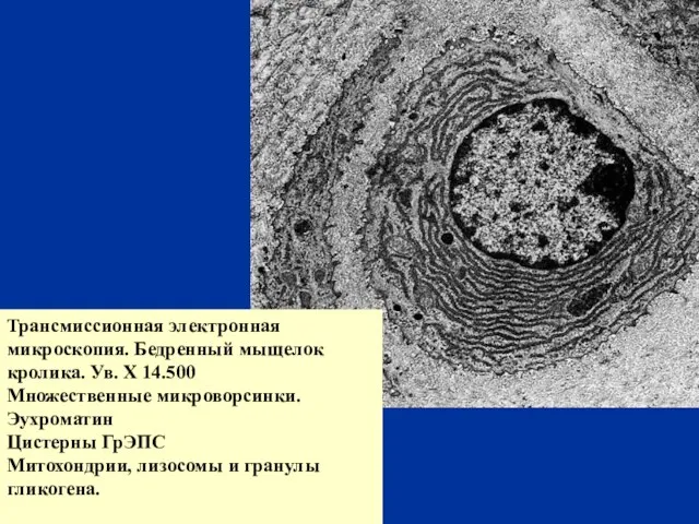 Трансмиссионная электронная микроскопия. Бедренный мыщелок кролика. Ув. Х 14.500 Множественные микроворсинки. Эухроматин