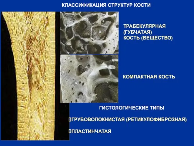 КЛАССИФИКАЦИЯ СТРУКТУР КОСТИ ТРАБЕКУЛЯРНАЯ (ГУБЧАТАЯ) КОСТЬ (ВЕЩЕСТВО) КОМПАКТНАЯ КОСТЬ ГИСТОЛОГИЧЕСКИЕ ТИПЫ ГРУБОВОЛОКНИСТАЯ (РЕТИКУЛОФИБРОЗНАЯ) ПЛАСТИНЧАТАЯ