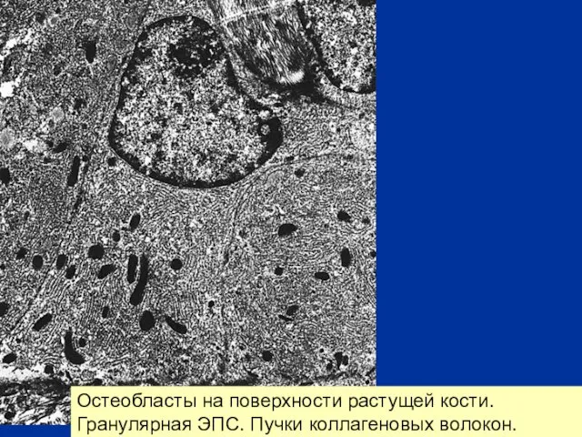 Остеобласты на поверхности растущей кости. Гранулярная ЭПС. Пучки коллагеновых волокон.