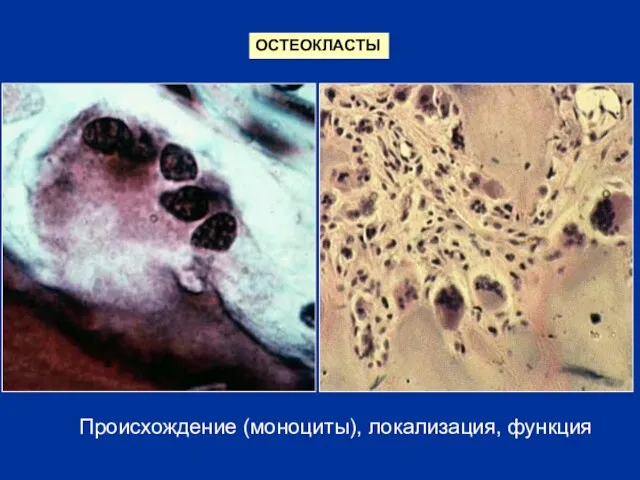 ОСТЕОКЛАСТЫ Происхождение (моноциты), локализация, функция