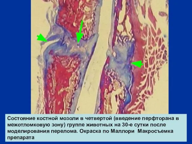 Состояние костной мозоли в четвертой (введение перфторана в межотломковую зону) группе животных