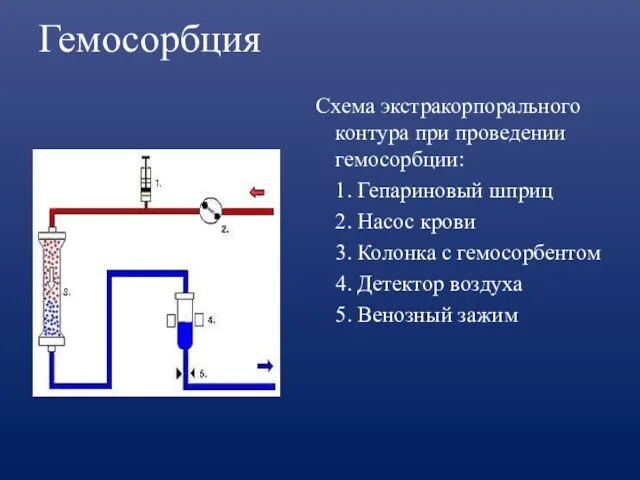 Гемосорбция Схема экстракорпорального контура при проведении гемосорбции: 1. Гепариновый шприц 2. Насос