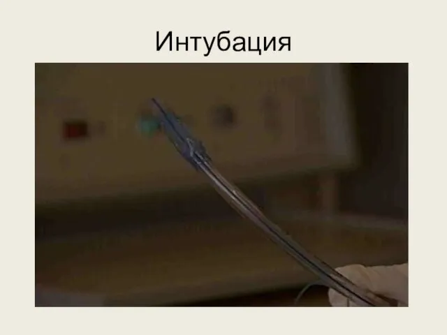 Интубация