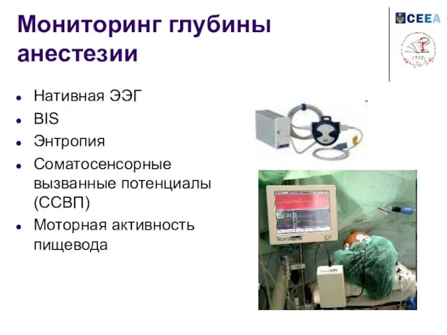 Мониторинг глубины анестезии Нативная ЭЭГ BIS Энтропия Соматосенсорные вызванные потенциалы (ССВП) Моторная активность пищевода