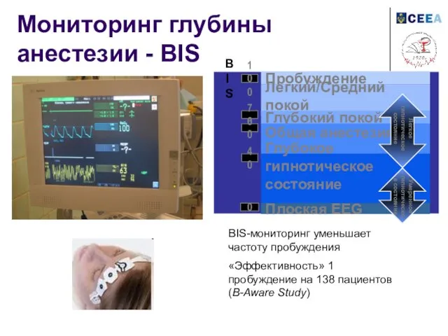 Мониторинг глубины анестезии - BIS BIS-мониторинг уменьшает частоту пробуждения «Эффективность» 1 пробуждение