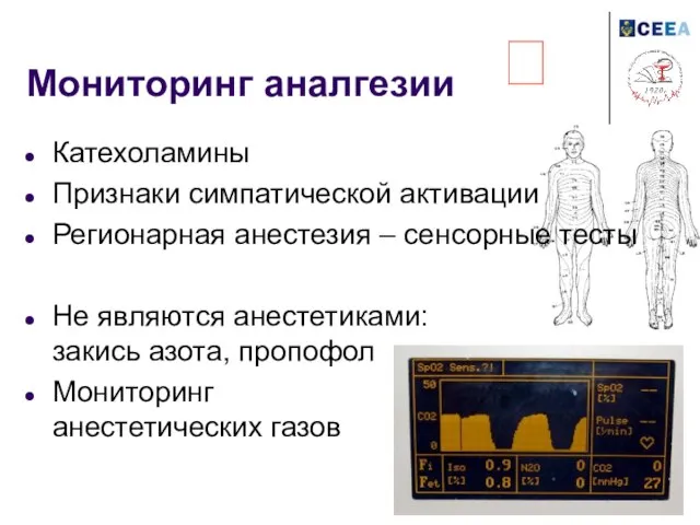 Мониторинг аналгезии Катехоламины Признаки симпатической активации Регионарная анестезия – сенсорные тесты Не