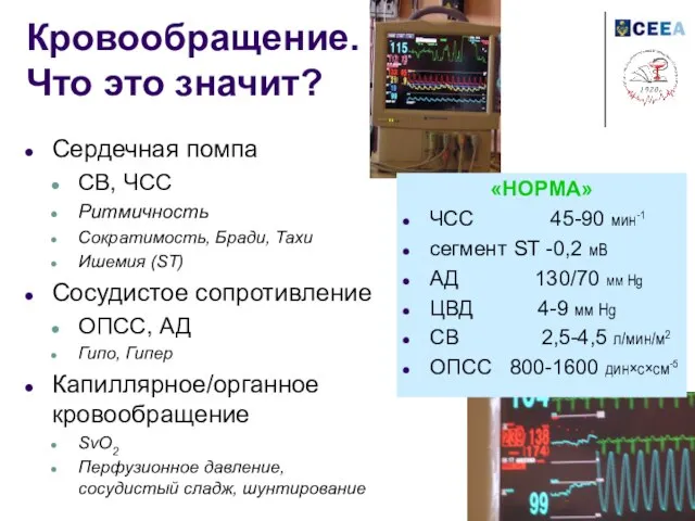 Кровообращение. Что это значит? Сердечная помпа СВ, ЧСС Ритмичность Сократимость, Бради, Тахи