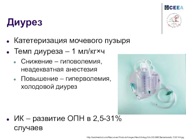 Диурез Катетеризация мочевого пузыря Темп диуреза – 1 мл/кг×ч Снижение – гиповолемия,