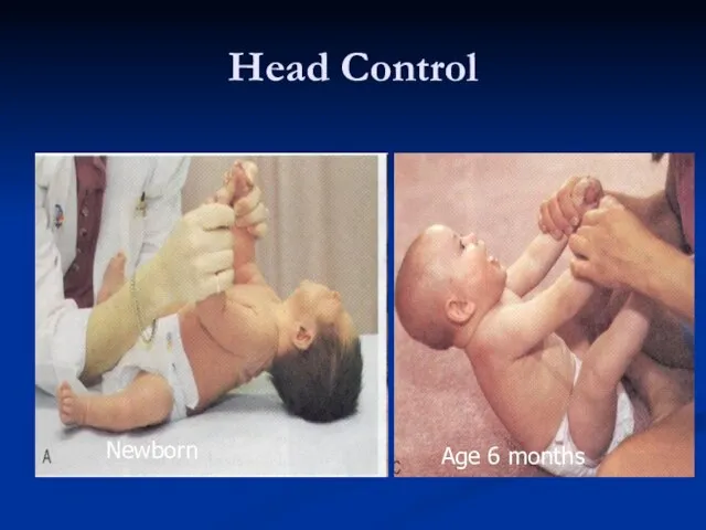 Head Control Newborn Age 6 months