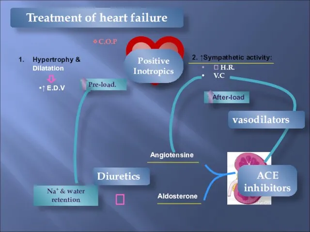 ⇩ C.O.P Hypertrophy & Dilatation ↑ E.D.V ⇩ 2. ↑Sympathetic activity: ⮥