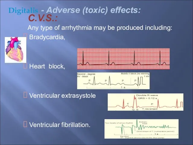 C.V.S.: Any type of arrhythmia may be produced including: Bradycardia, Heart block,