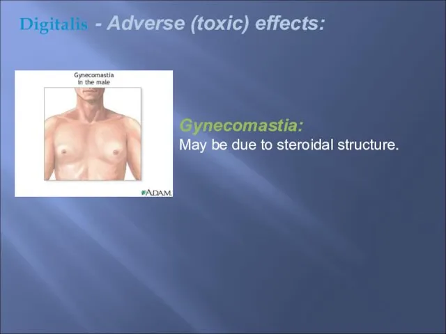 Gynecomastia: May be due to steroidal structure. Digitalis - Adverse (toxic) effects: